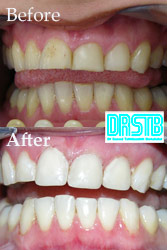 www.drstb.com