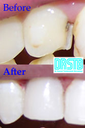 www.drstb.com