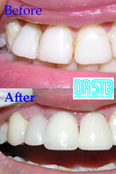 www.drstb.com