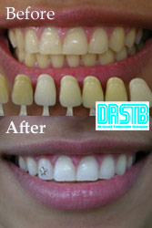 WWW.DRSTB.COM