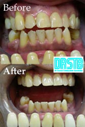 www.drstb.com
