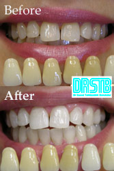 www.drstb.com