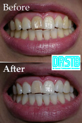 www.drstb.com