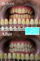 www.drstb.com