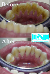 www.drstb.com