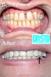 www.drstb.com